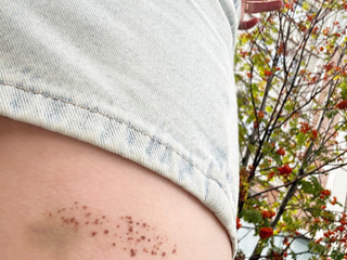 Mole