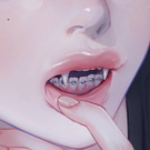 braces / брекеты