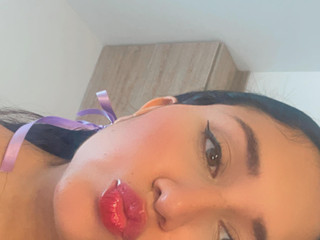 kiss