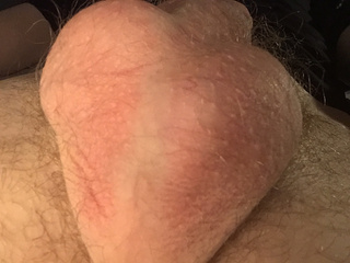 Balls