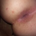 Vikabi1