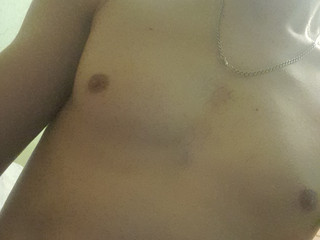 My Photos
