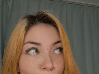 Freckles?
