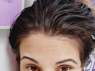 My Photos