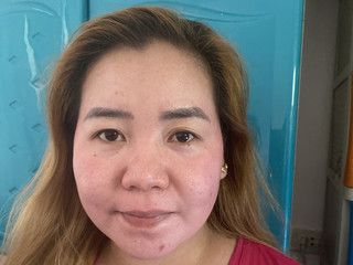My Photos