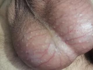 My balls!