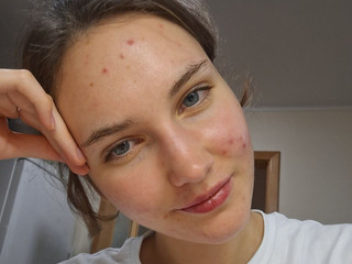 Megan