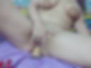 Anal