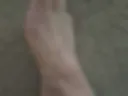 More toes