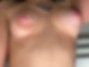 My unusual breasts