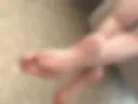 Legs
