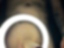 Penis