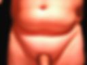 Bild11