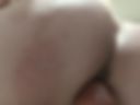 Anal