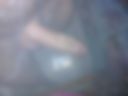 Penis
