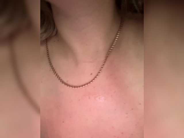 Gratis Live Sexcam mit _Lasker_ _Lasker_