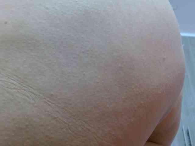 Candela-lat webcam