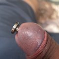 cvthnmdoctor