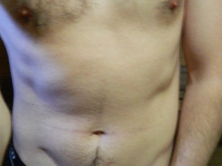 My Photos