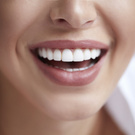 Classy teeth (veneers)