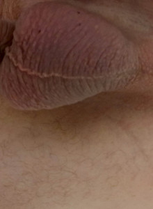 OopsAspirin 2007 photo 14328196