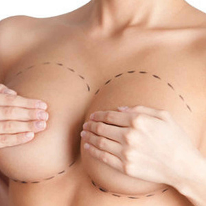 breast surgery