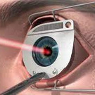 Лазерная коррекция зрения\Laser vision correction