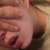 MindBreak