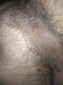 Jazz7373 hairy asshole photo 14657823