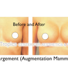 Body enhancement