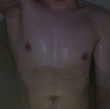 gtzm