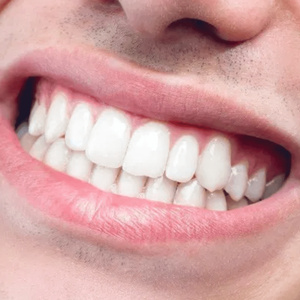 Зубы
