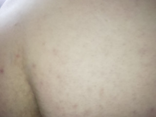 My Photos