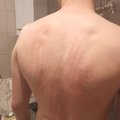 Gyneks18