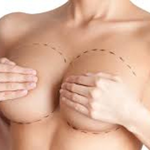 TO HAVE BREAST AUGMENTATION