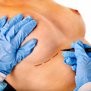 I want to have my boobs done