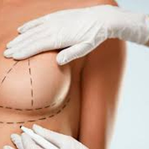 Surgery on my boobs
