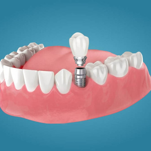 dentist