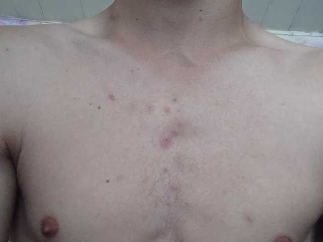 Arsenidze