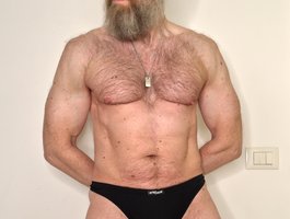 EdoSilver