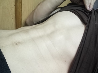 My Photos