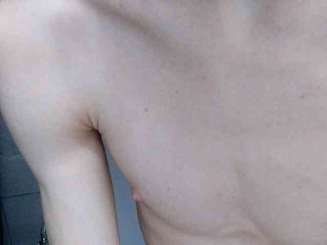 myacco