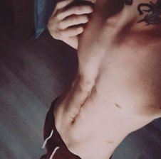 Anthony699