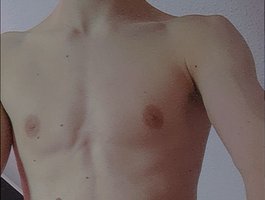 Twinklustbyemii