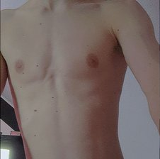 Twinklustbyemii