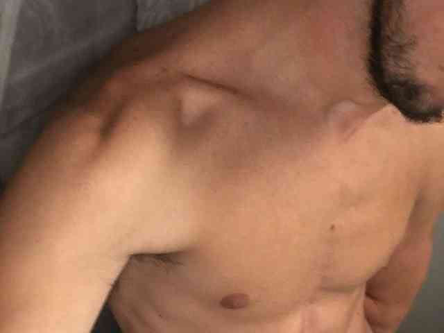 Marco156