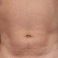 Andrey-18cm