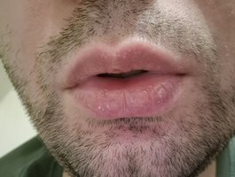 BADkasper01 BADkasper01