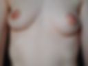 breast