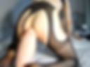 Anal 2